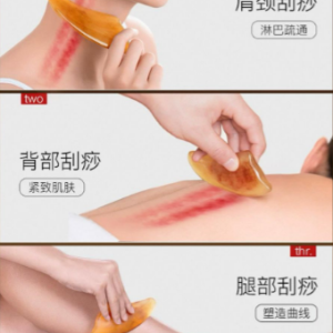 刮痧 Guasha